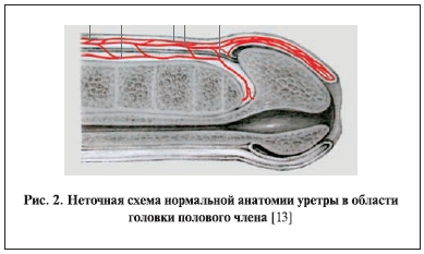 Неточная схема анатомии уретры в области головки полового члена
