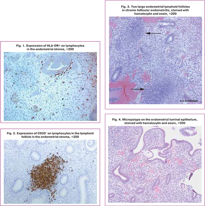 Immune response in women with different morphological forms of