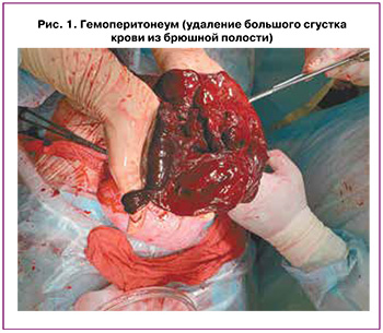 173-1.jpg (53 KB)