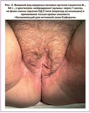 191-1.jpg (82 KB)
