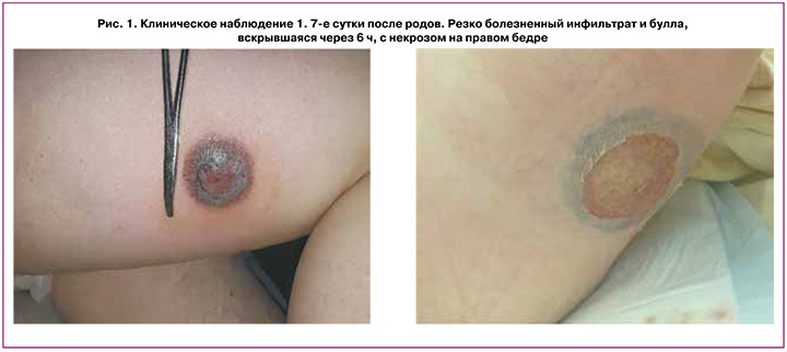 183-1.jpg (56 KB)
