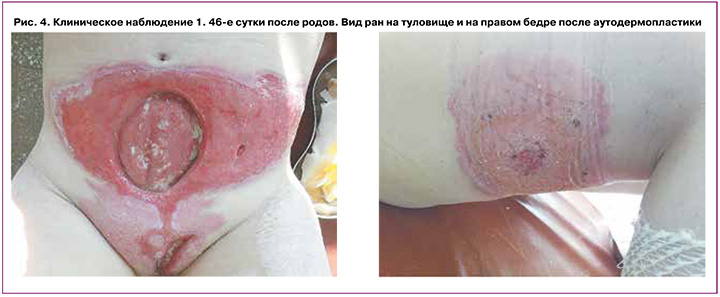 185-1.jpg (67 KB)