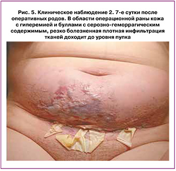185-2.jpg (49 KB)