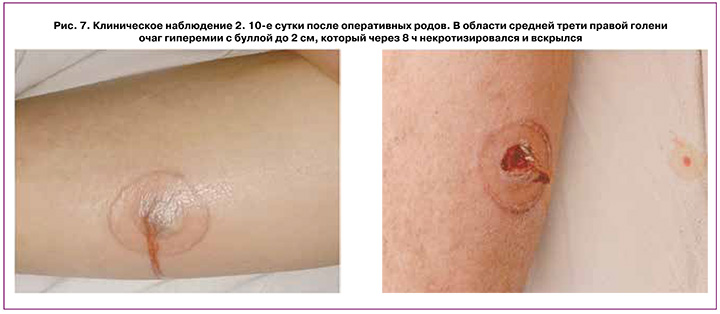186-2.jpg (57 KB)