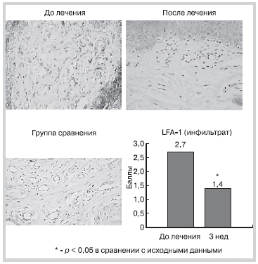 Рисунок 8 Динамика экспрессии LFA-1 в процессе леченияаторваcтатином
