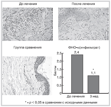 Рисунок 6 Динамика экспрессии ФНО α в процессе леченияаторваcтатином