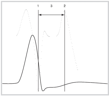Определение длительности интервала активация—восстановление