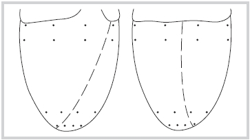 Распределение электродов по эпикардиальной поверхности желудочков у крысы