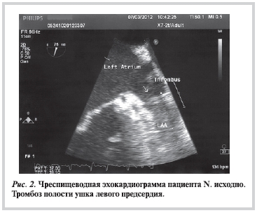 Рисунок 2 Рисунок 2