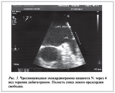 Рисунок 3 Рисунок 3