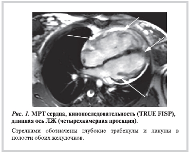 Рисунок 1 Рисунок 1