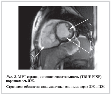 Рисунок 2 Рисунок 2