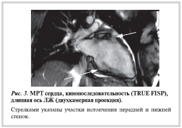 Рисунок 3 Рисунок 3