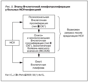 Этапы В-клеточной лимфопролиферации у больных HCV-инфекцией