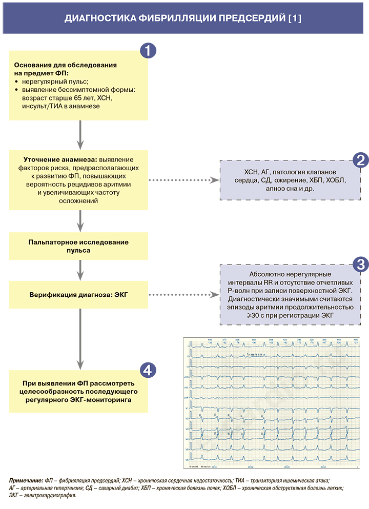 Фибрилляция предсердий схема лечения