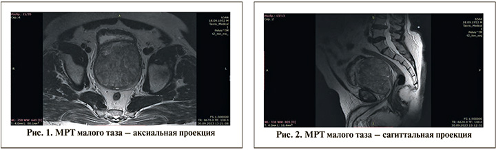 95-1.jpg (50 KB)